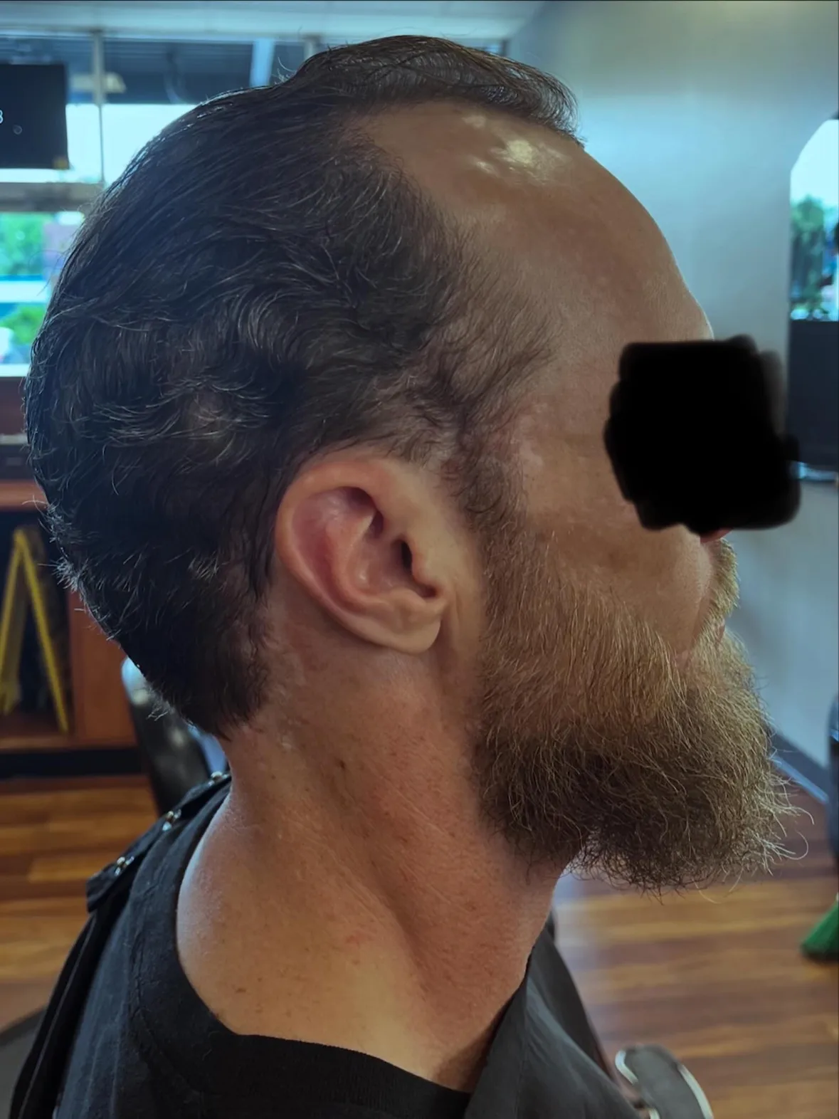 After: a short, clean haircut with a neatly trimmed beard in profile
