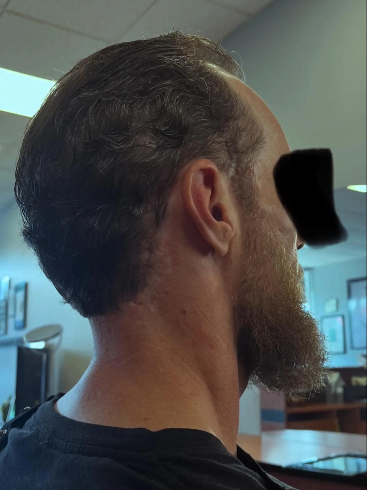 After: a tapered cut with a clean neckline and a shaped beard